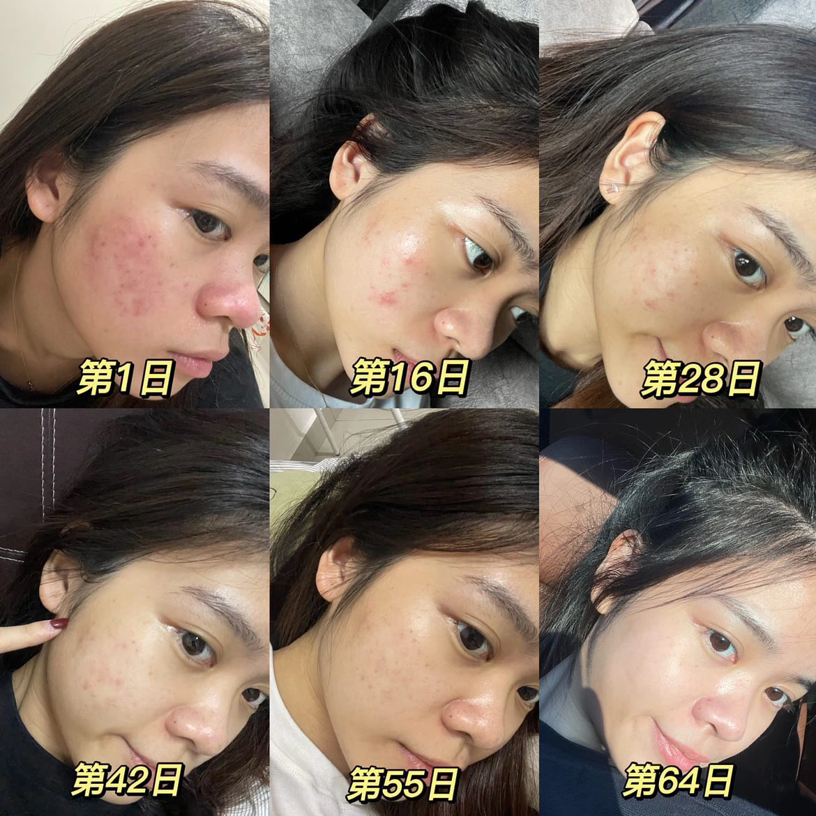 After Skin