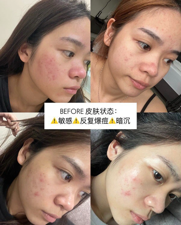 Before Skin